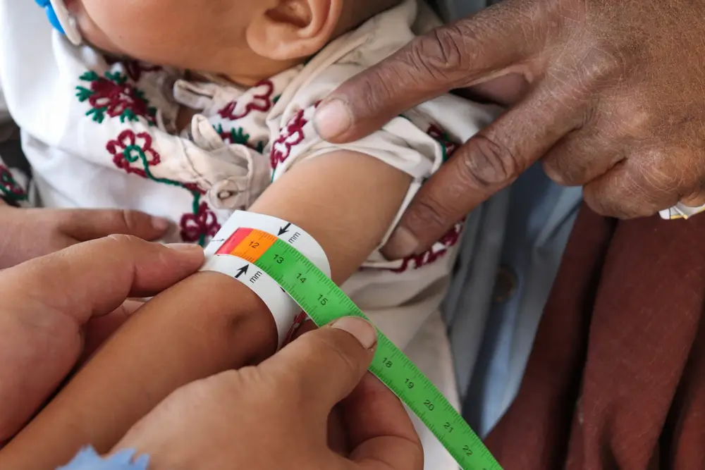 Una enfermera de MSF mide el brazo de un bebé con una cinta de circunferencia de la parte media superior del brazo (MUAC).