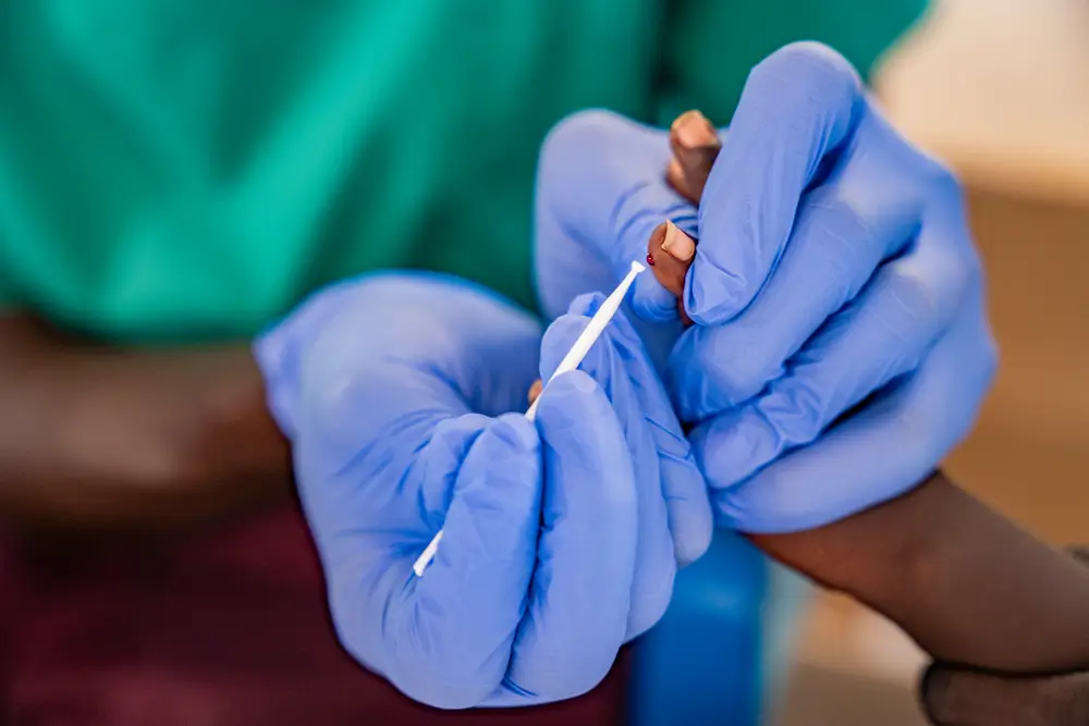 Recolección de sangre para realizar una prueba de malaria.