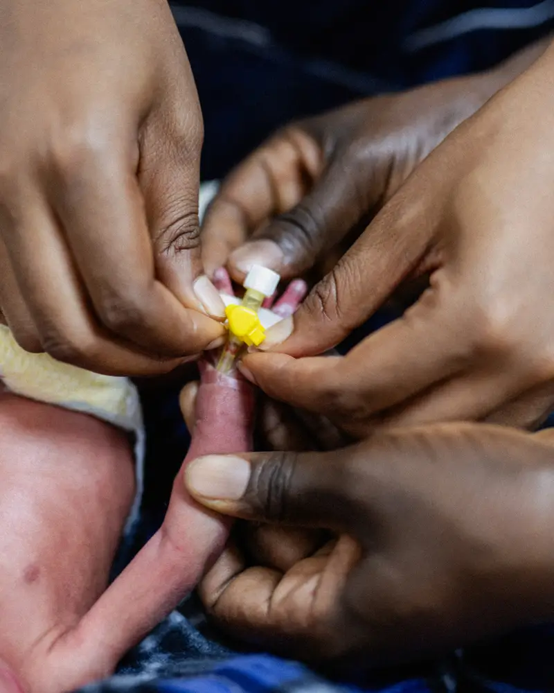 Se está insertando una cánula dentro de la mano de un bebé prematuro en el centro de atención integral de emergencia obstétrica y neonatal construido por MSF en el Hospital Nilefa Keji en Maiduguri, estado de Borno.