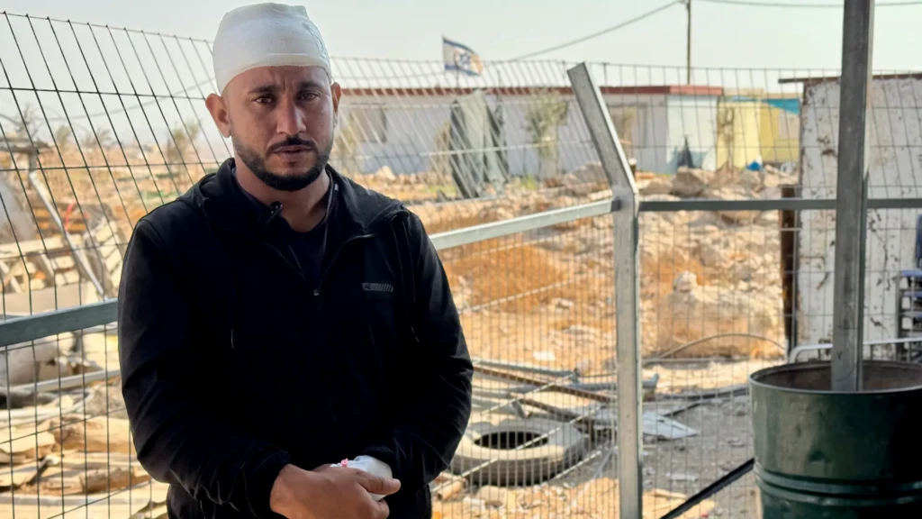 "Un colono me dio un golpe en la cabeza con un palo. Casi pierdo el conocimiento y me llevaron al hospital. Sin embargo, no se tomó ninguna medida contra él", Ahmed Al-Hadhlin, en um Al-Kheir. Septiembre de 2025.