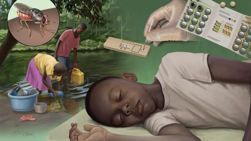 Niño con enfermedad del sueño, mosca tsé tsé, prueba rápida y medicación.