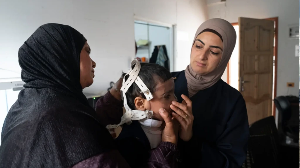 En el taller de fisioterapia 3D de la clínica de MSF en Gaza, Ibtihal, fisioterapeuta de MSF, coloca una máscara 3D a Joud, un niño de cuatro años con quemaduras. Palestina, marzo de 2026.