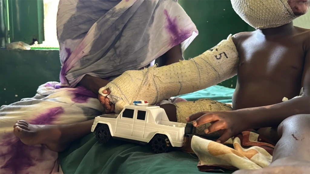 En el Hospital Universitario Zalingei, Darfur Central, Mohammed, de cuatro años, se está recuperando en la sala de cirugía tras sufrir graves quemaduras en un incendio doméstico. 