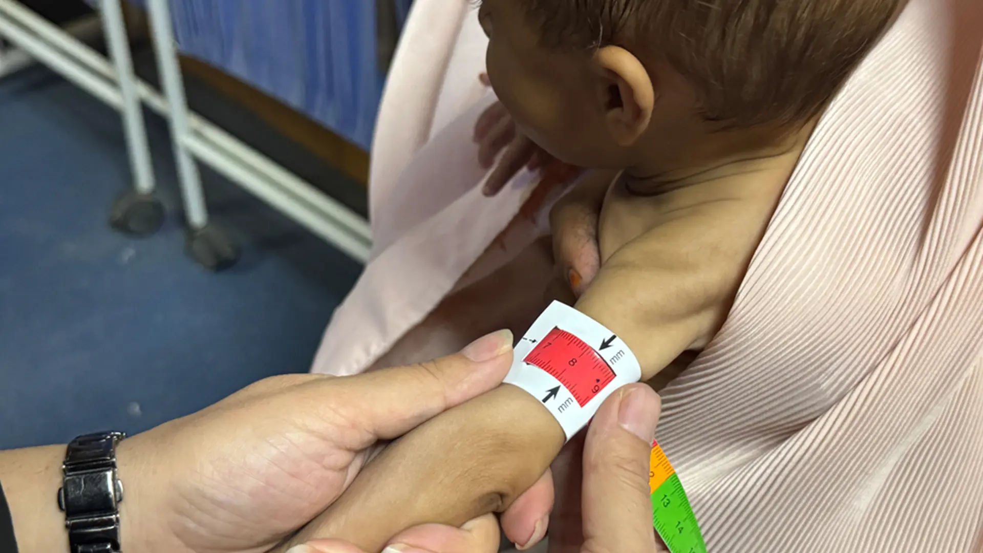 Una enfermera de MSF utiliza una cinta de circunferencia media y superior del brazo (MUAC) para evaluar a un bebé durante un triaje en el centro ambulatorio de alimentación terapéutica de MSF en Kandahar, sur de Afganistán.