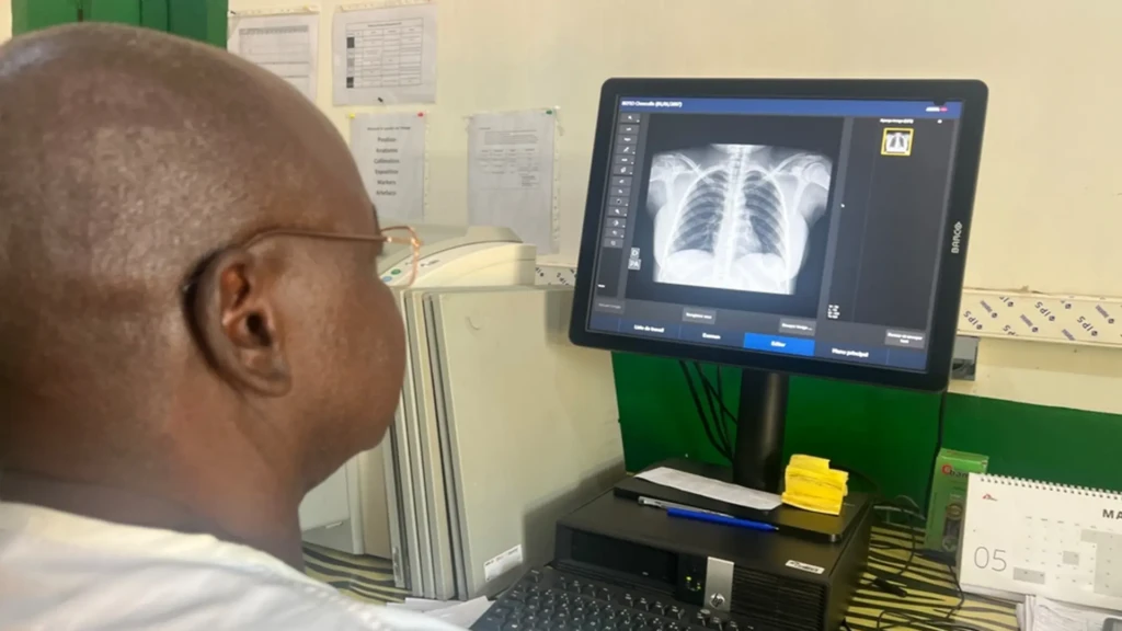 Uso de IA para apoyar el diagnóstico de tuberculosis en Batangafo y RCA