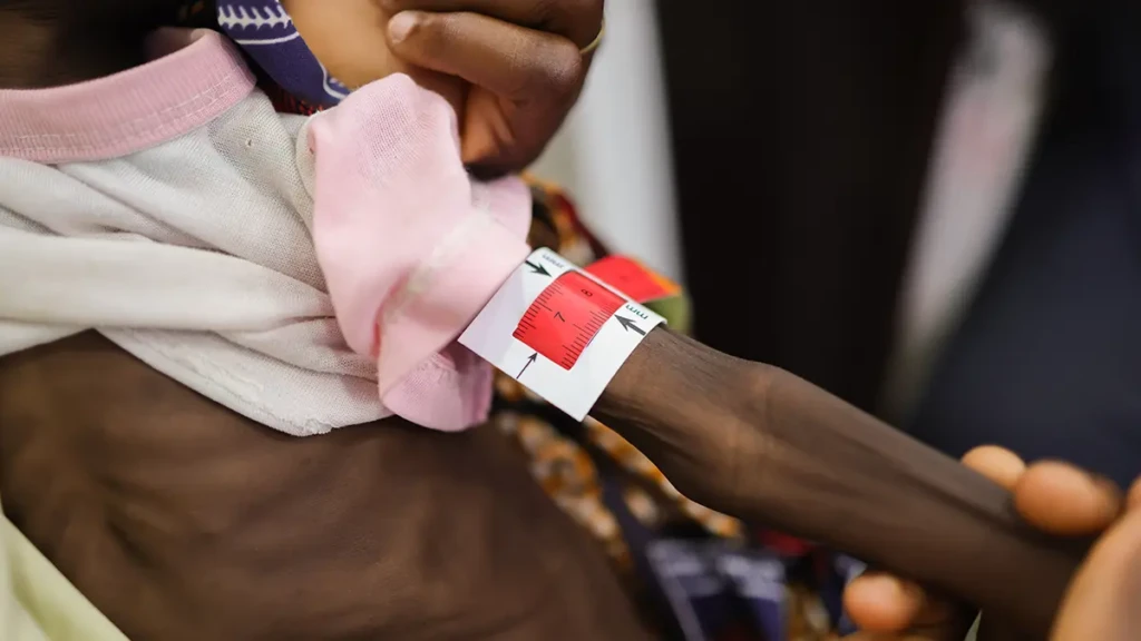 Impacto de la desnutrición en la salud mental en los cuidadores en Nigeria.