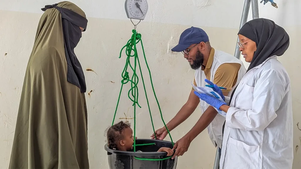 Personal de MSF pesan a un niño al ingresar en la unidad de desnutrición del Hospital Regional de Mudug.