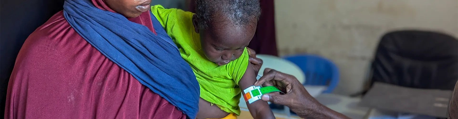 Desnutrición ene Somalia