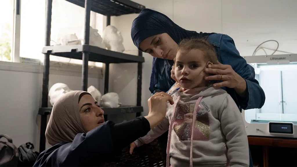Durante una sesión de seguimiento en la clínica de MSF en la ciudad de Gaza, Ibtihal, fisioterapeuta de MSF, realiza ajustes en la máscara 3D de Salam para mejorar su adaptación a medida que sanan sus quemaduras faciales.