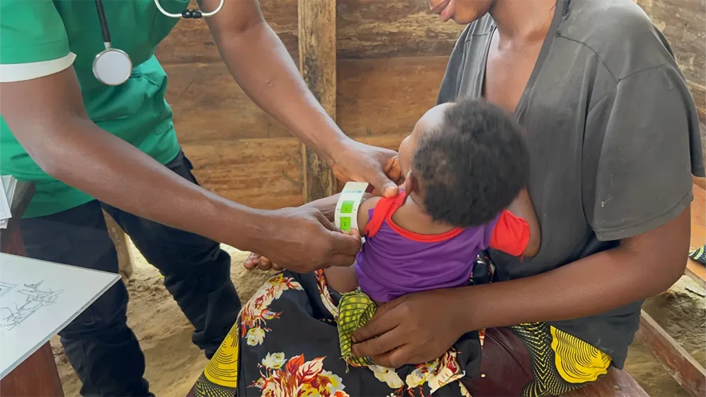 Equipo de MSf mide el brazo medio superior de un niño para evaluar signos de desnutrición durante el triaje en el puesto de saludNgora, Kivu Norte, RDC.