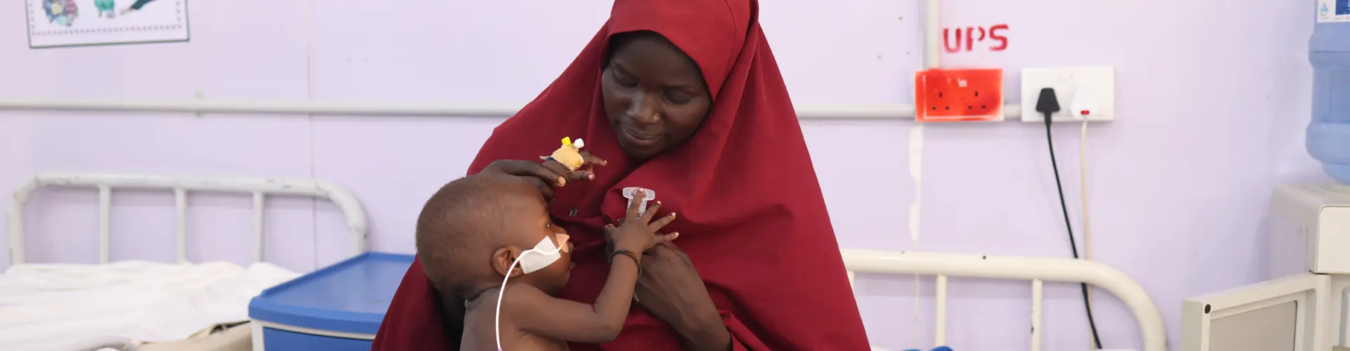 Un paciente con kwashiorkor en un centro apoyado por MSF. © Abba Adamu Musa/MSF