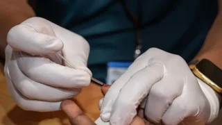 Hepatitis C en los campos Rohingyas en Bangladesh