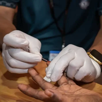 Hepatitis C en los campos Rohingyas en Bangladesh