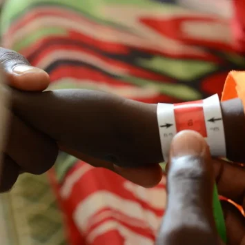 Un niño en un cribado de circunferencia del brazo en el centro de alimentación terapéutica ambulatoria de la clínica de MSF en el campo de Zamzam.